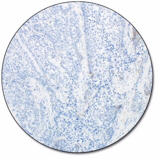 PD-L1 IHC 28-8 pharmDx for Autostainer Link 48